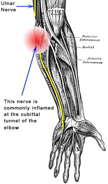 ulnarnerve.jpg